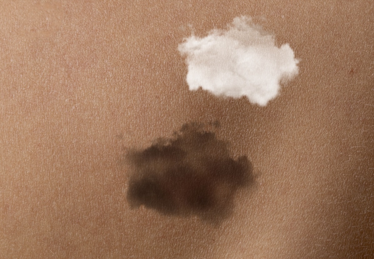 AKQA Brussels sort couverte pour Melanoompunt