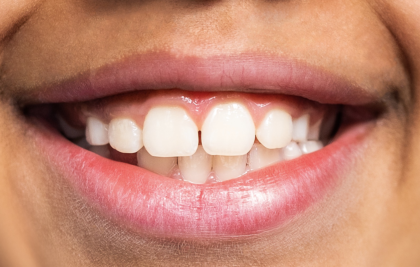 Soniq Sweet Spot: AKQA Brussels zet zijn tanden in Helan